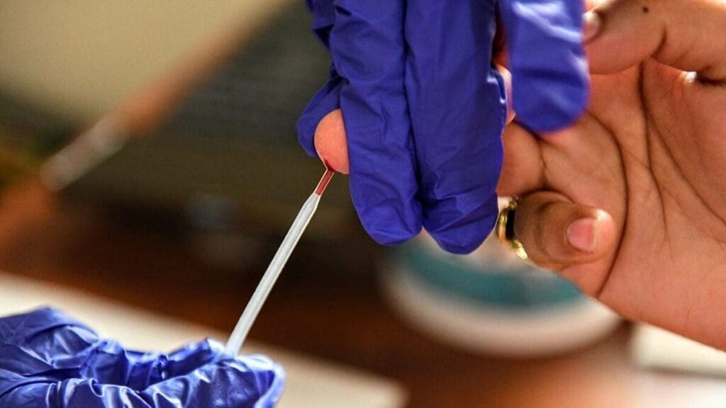 ¡Increíble! Veracruz sorprende al mundo con 850 casos de VIH en solo seis meses 1 increible veracruz sorprende al mundo con 850 casos de vih en solo seis meses